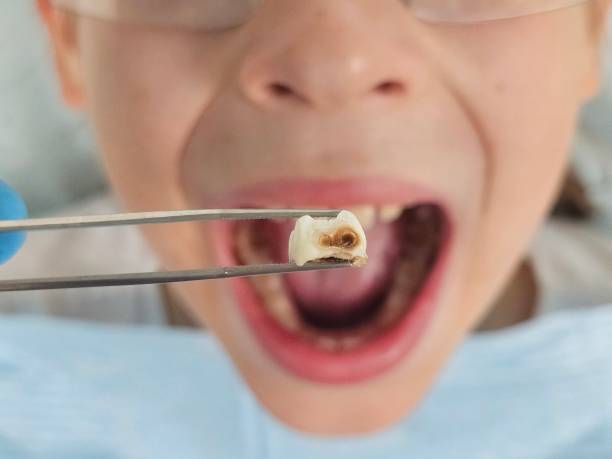 Best Chipped Tooth Repair Near Me  in Williamstown, PA